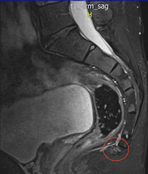 Christian MRI 1
