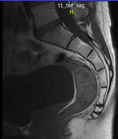 Christian MRI 2