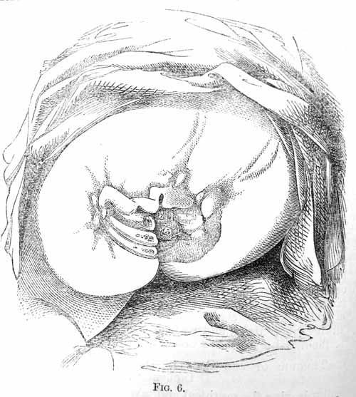 Fig 6.